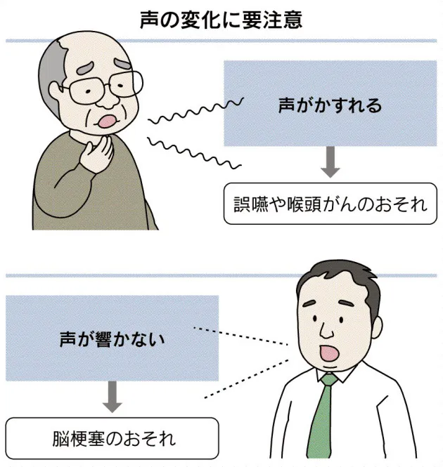 肺炎 脳梗塞 ストレス 声は健康のバロメーター Nikkei Style