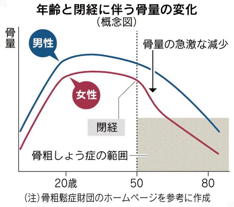 牛乳や豆腐摂取し予防 骨粗しょう症 男性も注意 糖尿病 喫煙者は高リスク Nikkei Style