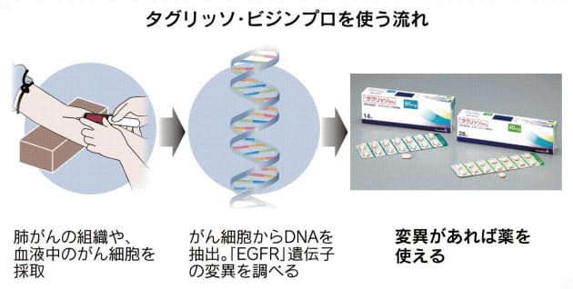 肺がん治療 タイプごとに 新薬相次ぎ選択肢広がる Nikkei Style
