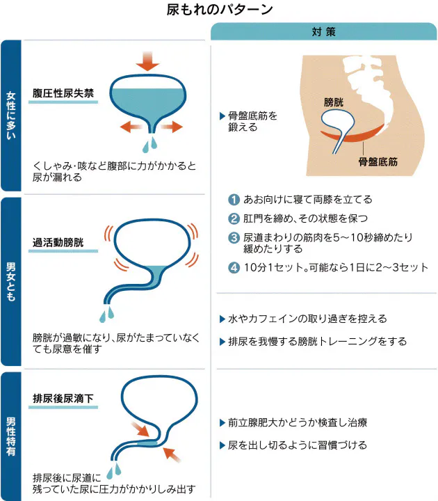 尿もれには 膀胱トレーニング 骨盤底筋体操で備える Nikkei Style
