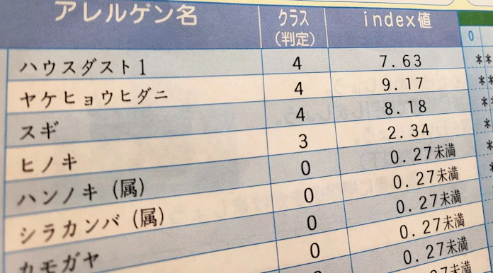 冬のアレルギー性鼻炎 ハウスダストが原因 風邪に似た症状 日本経済新聞 冬のアレルギー性鼻炎 ハウスダストが原因 風邪に似た症状 日本経済新聞