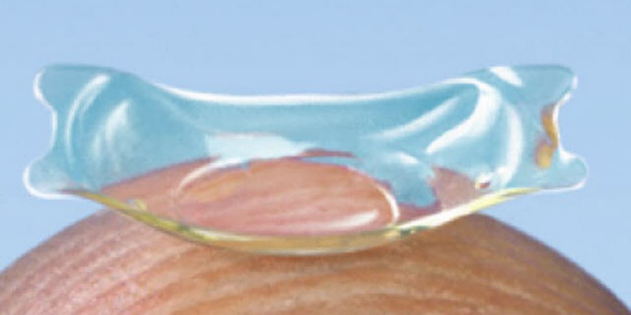 近視に 眼内レンズ 若者が注目 手術の安全性高く Nikkei Style 近視に 眼内レンズ 若者が注目 手術の安全性高く Nikkei Style