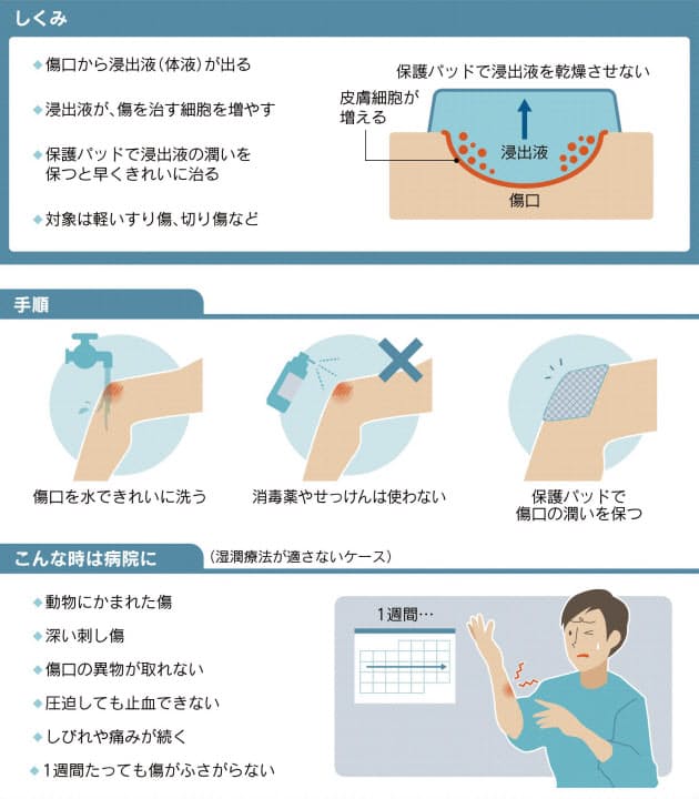 傷口湿らせて治す 湿潤療法 消毒は不要 水で流す Nikkei Style