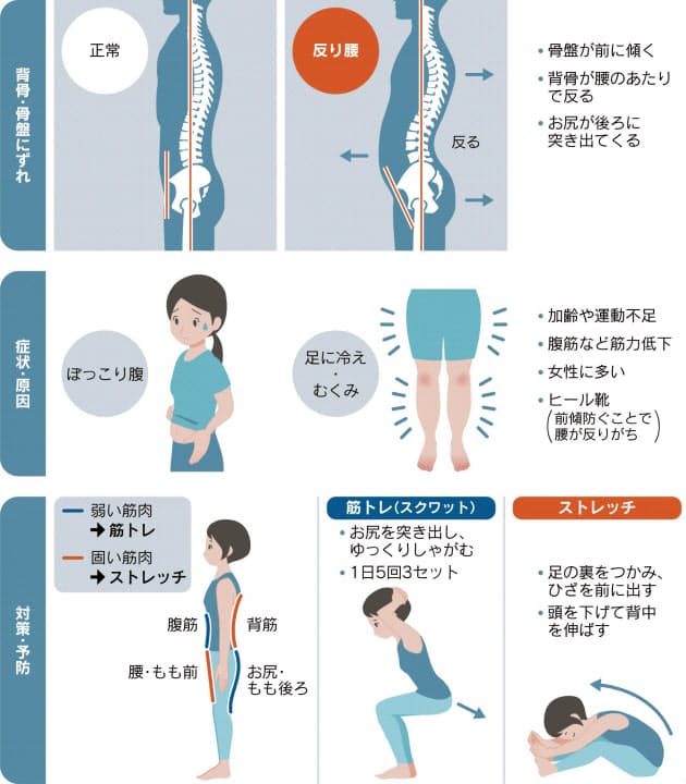 ぽっこり腹は反り腰かも 筋トレとストレッチで改善 Nikkei Style