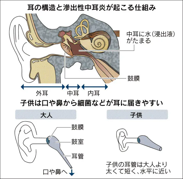 耳を触る 言葉遅い 反応鈍い 子供 中耳炎かも Nikkei Style 耳を触る 言葉遅い 反応鈍い 子供 中耳炎かも Nikkei Style