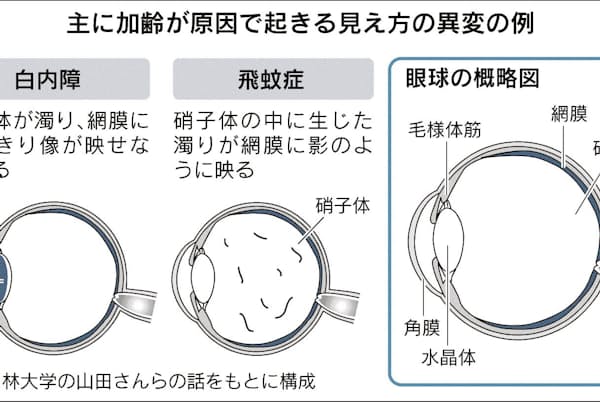 視野欠ける チカチカする こんな見え方は要注意 Nikkei Style 視野欠ける チカチカする こんな見え方は要注意 Nikkei Style