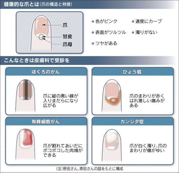 色はピンクで濁りなく 健康な爪を保つ方法 Nikkei Style 色はピンクで濁りなく 健康な爪を保つ方法 Nikkei Style