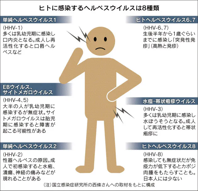 ヘルペス ヒトへの感染は8種類 妊婦は要注意 Nikkei Style ヘルペス ヒトへの感染は8種類 妊婦は要注意 Nikkei Style