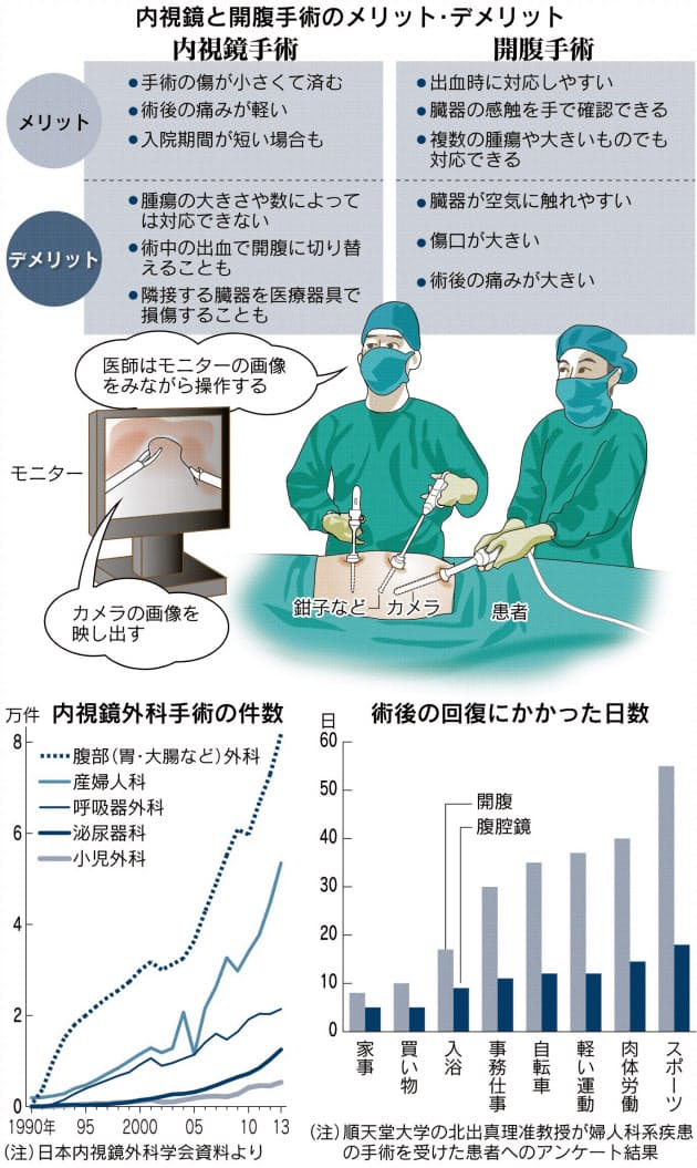 内視鏡手術 早い回復 開腹より小さい傷 Nikkei Style 内視鏡手術 早い回復 開腹より小さい傷 Nikkei Style