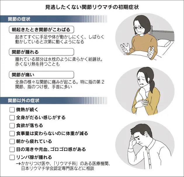 こわばる関節 リウマチの可能性 30代から発症も Nikkei Style