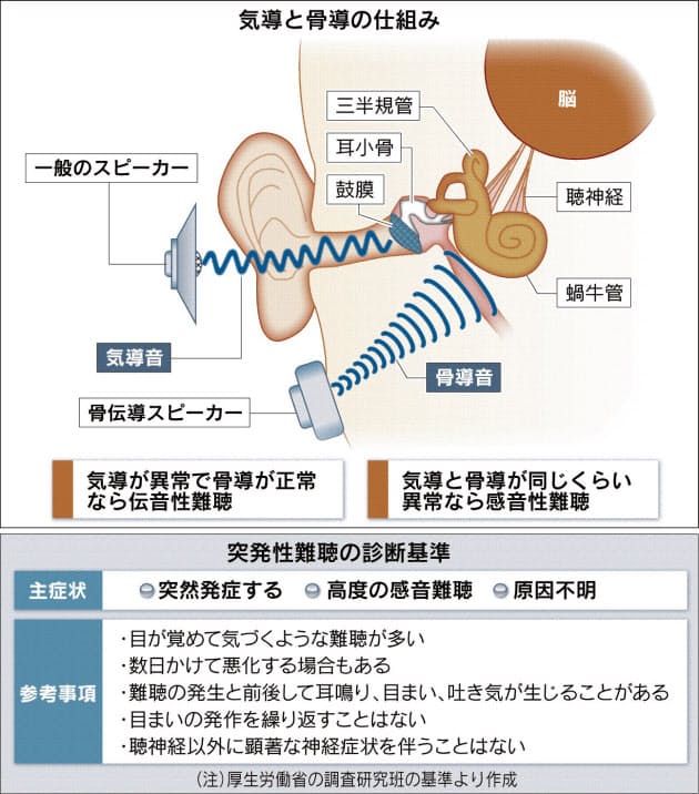 あれ 急に耳が聞こえない 突発性難聴 原因不明 再生医療に光 Nikkei Style