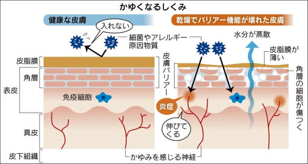 我慢できない皮膚のかゆみ 改善策は Nikkei Style 我慢できない皮膚のかゆみ 改善策は Nikkei Style
