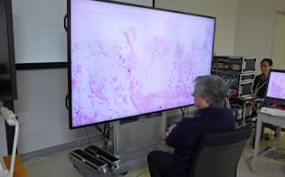 東大病院の佐々木毅氏は8Kの大画面を見て細胞の悪性か良性を瞬時に判断する