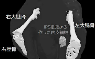 大阪大 Ips細胞で世界初の心臓病治療へ 日本経済新聞