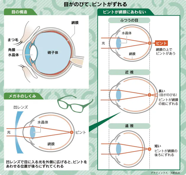 なぜ人は目が悪くなるの 遠くが見えにくい理由は Nikkei Style