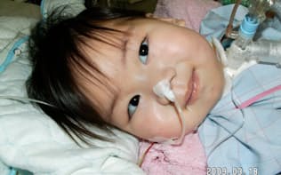 人工呼吸器をつけて満面の笑みを見せた生後11カ月の息子（2009年3月）