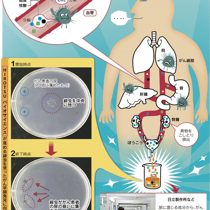 体臭で何の病気かがわかるの 2ページ目 日経ビジネス電子版