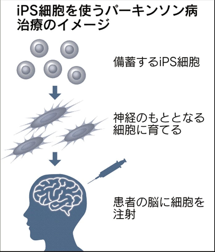 Ips移植 パーキンソン病患者の脳に 京大が治験 日本経済新聞