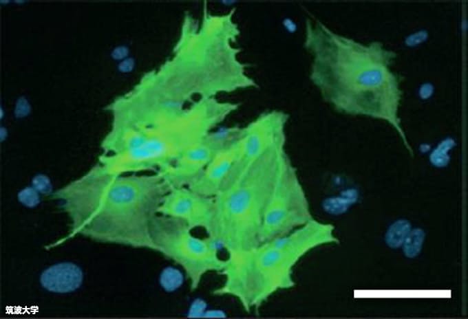 筑波大など Ips使わず心筋再生 遺伝子導入の新手法 日本経済新聞