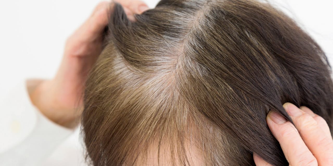 どうして年を取ると白髪ができるの Nikkei Style どうして年を取ると白髪ができるの Nikkei Style