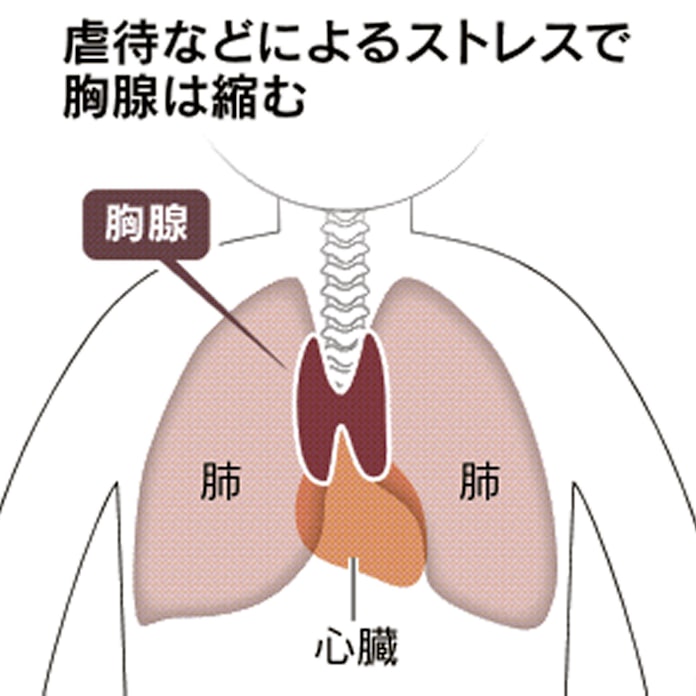 12年前の乳児虐待死 法医学の蓄積が逮捕の決め手に 日本経済新聞 12年前の乳児虐待死 法医学の蓄積が逮捕の決め手に 日本経済新聞