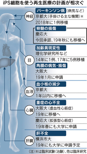 再生 医療