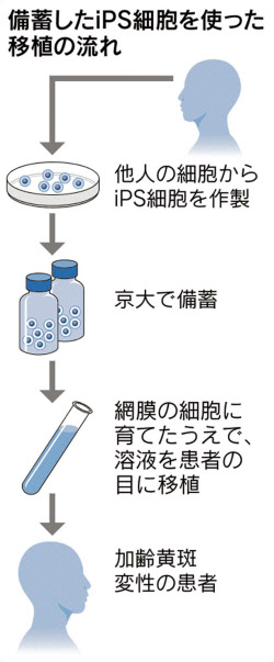 他人のips移植 実用化へ7合目 理研 術後良好 日本経済新聞