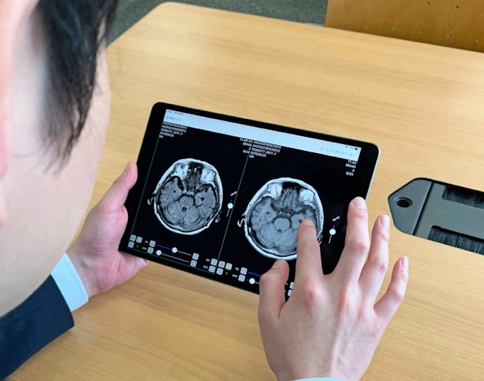 キヤノンmj 医療画像をスマホで共有 医師向け 日本経済新聞
