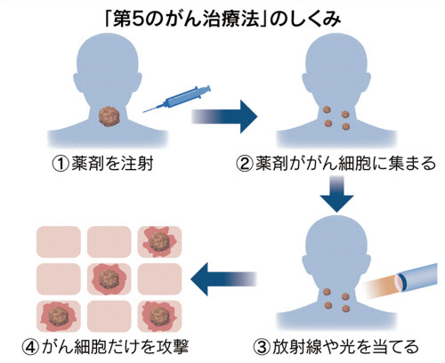 がん治療に第5の道 住友重機 ローム 楽天が競う 日本経済新聞