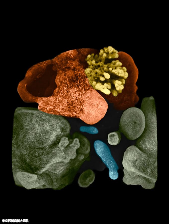 Ips細胞で ミニ多臓器 肝臓や膵臓など連結 東京医歯大 日本経済新聞