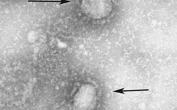 中国・武漢市で発生した肺炎の原因とされる新型のコロナウイルスの電子顕微鏡写真（中国疾病予防コントロールセンター、GISAID提供）