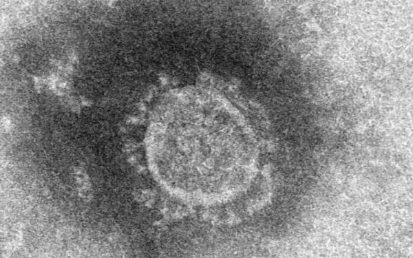 新型コロナウイルスの電子顕微鏡写真=国立感染症研究所提供・共同