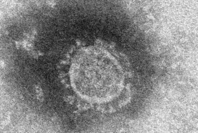新型コロナウイルスの電子顕微鏡写真＝国立感染症研究所提供・共同