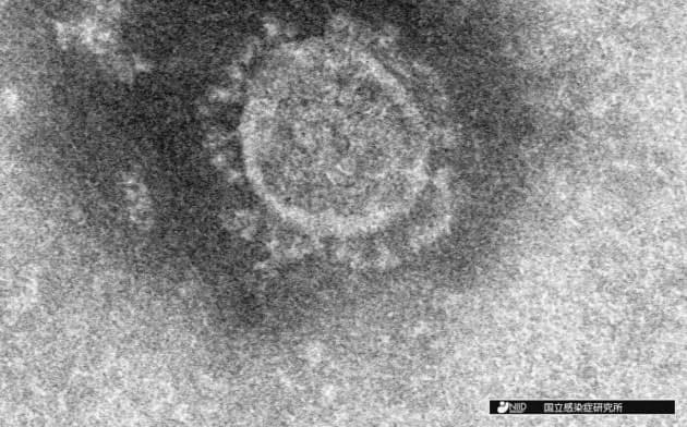 新型コロナウイルスの電子顕微鏡写真=国立感染症研究所提供・共同 新型コロナウイルスの電子顕微鏡写真=国立感染症研究所提供・共同