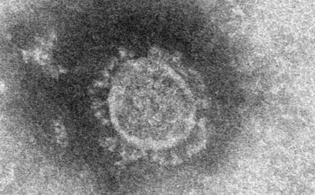 新型コロナウイルスの電子顕微鏡写真=国立感染症研究所提供・共同 新型コロナウイルスの電子顕微鏡写真=国立感染症研究所提供・共同