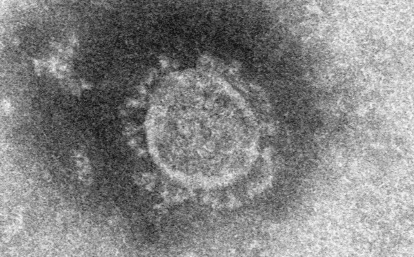 ウイルス 新型 韓国 コロナ 韓国と日本のPCR検査実施人数等比較 (新型コロナウイルス：Coronavirus)