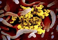 米国立衛生研究所が公表した新型コロナウイルスの顕微鏡写真=AP 米国立衛生研究所が公表した新型コロナウイルスの顕微鏡写真=AP