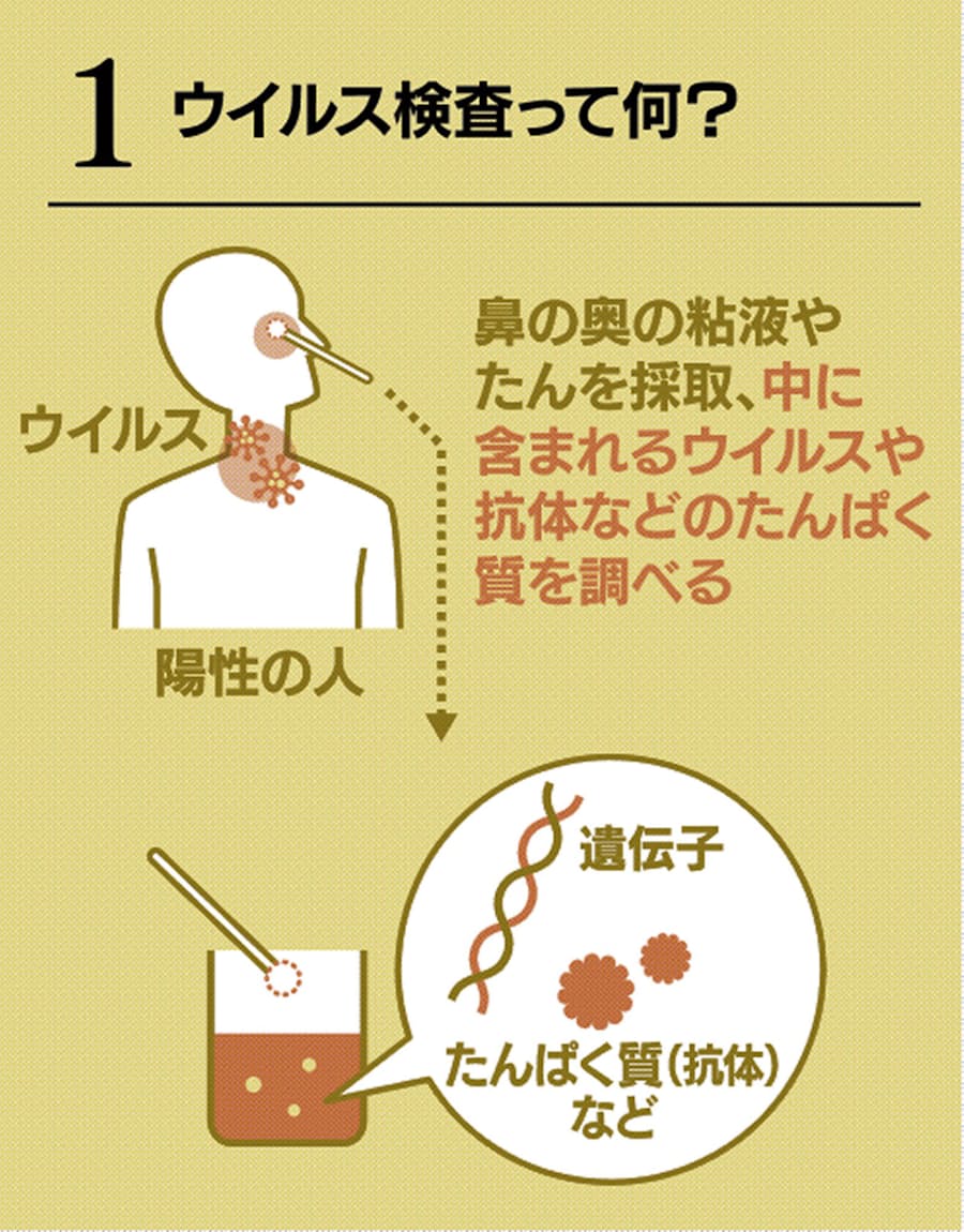 新型コロナ:よくわかるウイルス検査 新型コロナ、保険適用始まる: 日本 ...