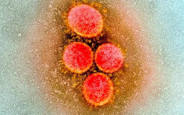 患者から取り出された新型コロナウイルスの写真（米国立アレルギー感染症研究所提供）