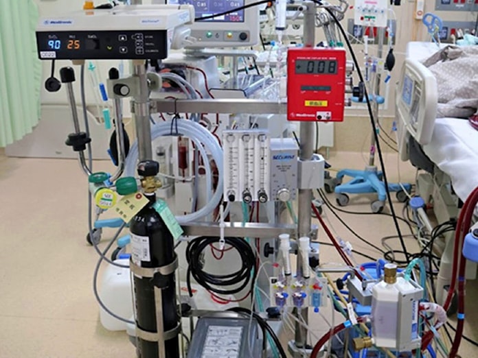 新型コロナ: 新型コロナ治療に「人工肺」 経験豊富な人材少なく: 日本経済新聞