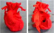 3Dプリンターで心臓模型を作り、小児の心臓手術の予行演習に役立てる(国立循環器病研究センター提供) 3Dプリンターで心臓模型を作り、小児の心臓手術の予行演習に役立てる(国立循環器病研究センター提供)