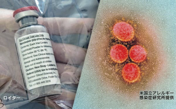 新型コロナウイルス治療薬候補「レムデシビル」は世界で14万人分が供給されるものの日本向けはごく一部に限られる見込み