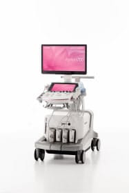 キヤノンメディカルの超音波診断装置は細かい血流や立体的に胎児が動く様子を観察できる キヤノンメディカルの超音波診断装置は細かい血流や立体的に胎児が動く様子を観察できる