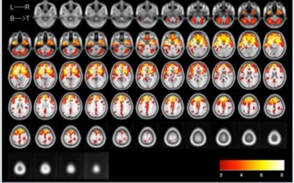 ERISAのソフトを通した脳のMRI画像（同社提供）