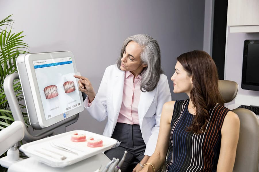 インビザライン 歯列矯正をアプリで管理 日本経済新聞