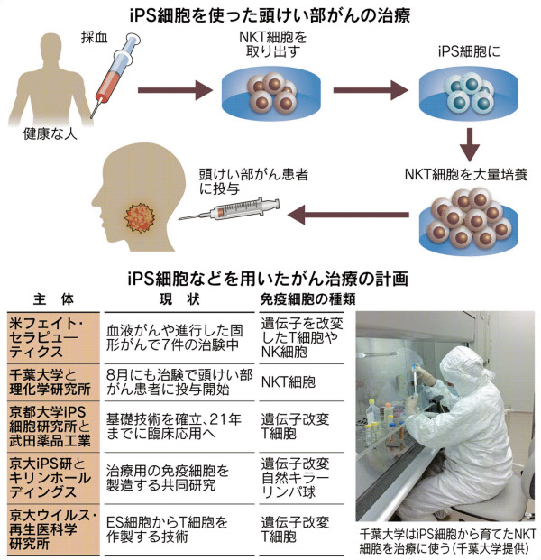 Ipsでがん治療 免疫細胞を量産 病巣を攻撃 日本経済新聞