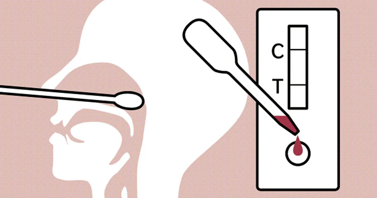 新型コロナ 見てわかる コロナ検査 Pcr 抗原 抗体の特徴とは 日本経済新聞 新型コロナ 見てわかる コロナ検査 Pcr 抗原 抗体の特徴とは 日本経済新聞