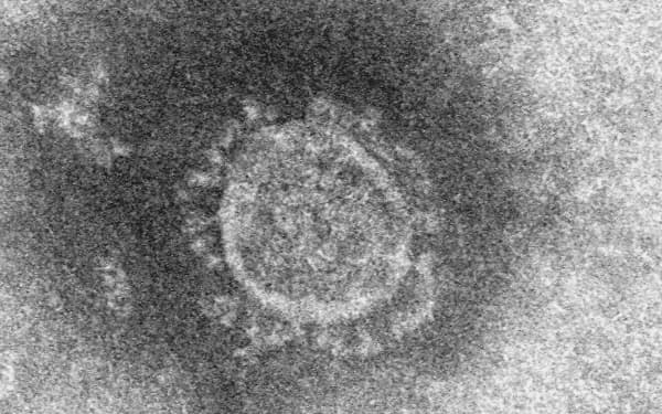 新型コロナウイルスの電子顕微鏡写真=国立感染症研究所提供