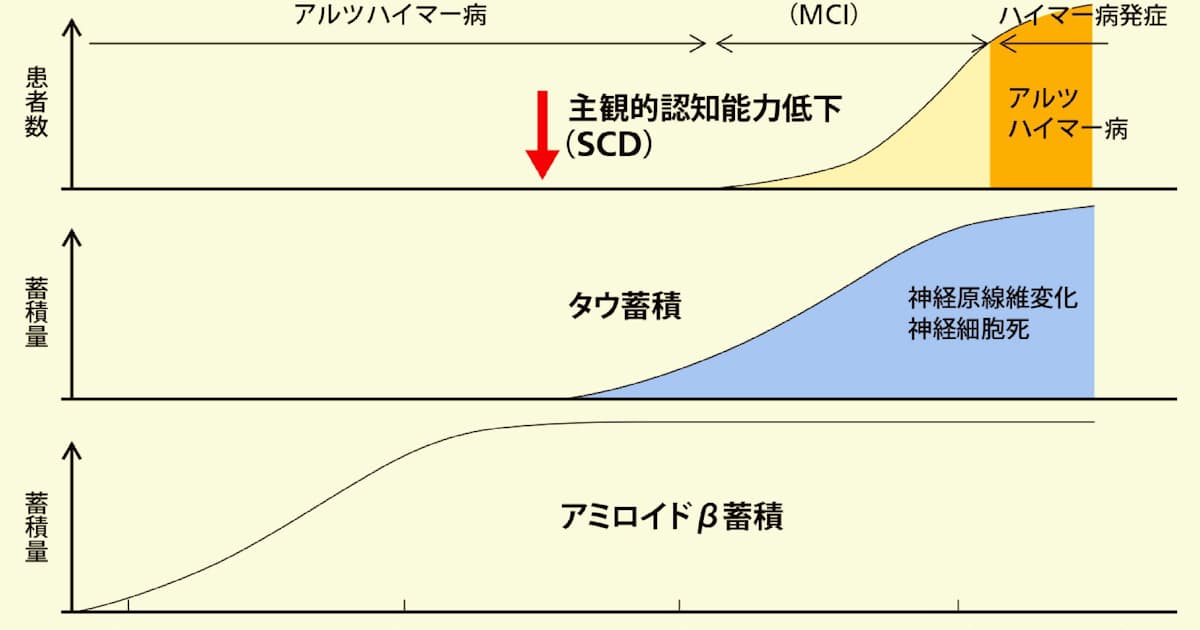 アルツハイマー病治療薬 発病前に阻止する戦略に転換 日本経済新聞 アルツハイマー病治療薬 発病前に阻止する戦略に転換 日本経済新聞