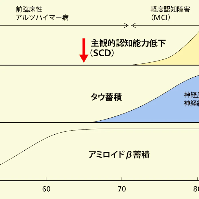 アルツハイマー病治療薬 発病前に阻止する戦略に転換 日本経済新聞